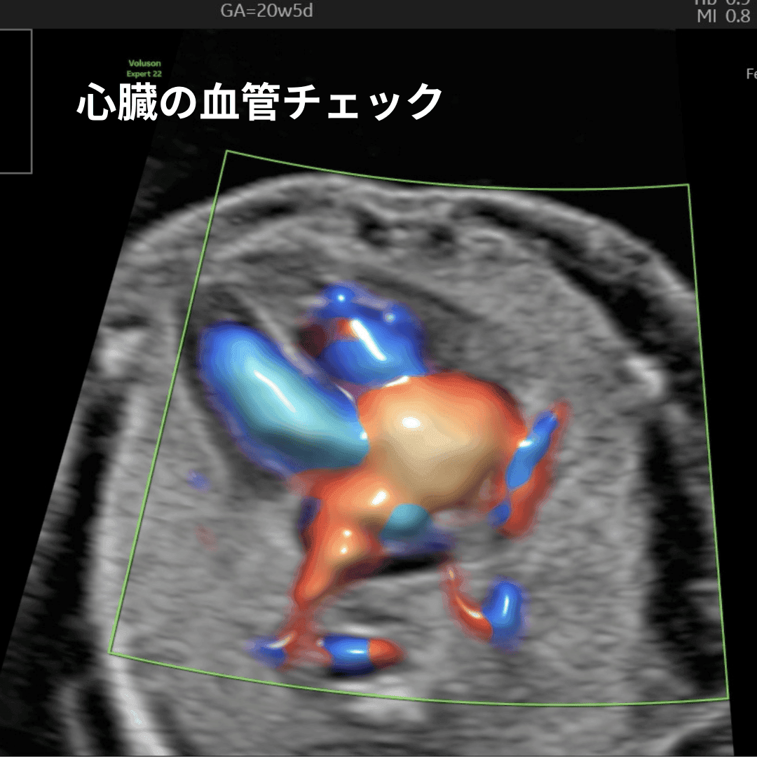 カラードプラで心臓の血管を確認している超音波画像